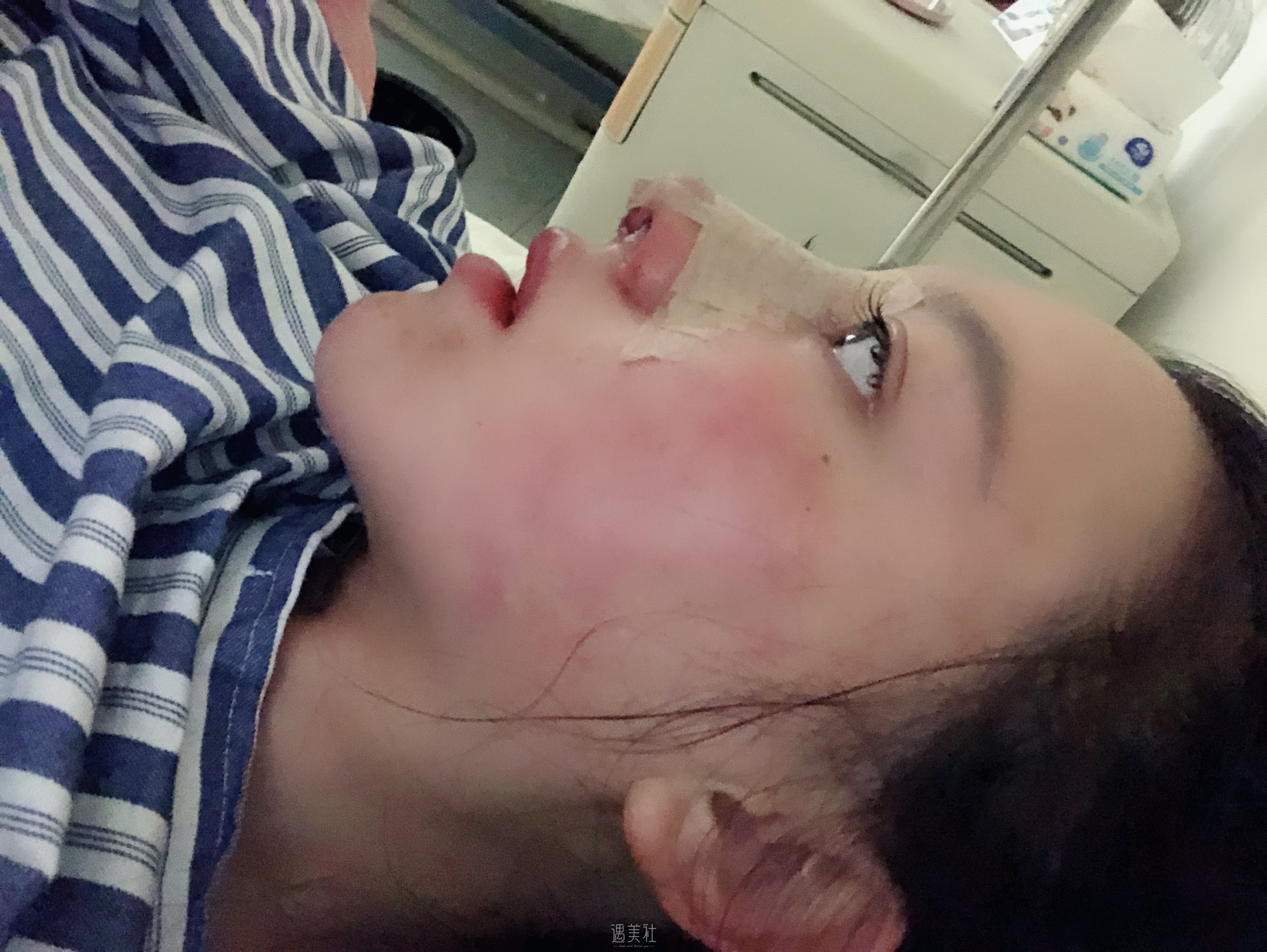 杭州港丽医疗美容——【眼部多项】七天美眼