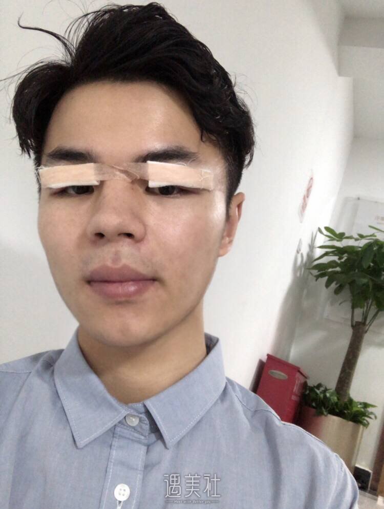 北京画美医疗美容医院——【眼部多项】