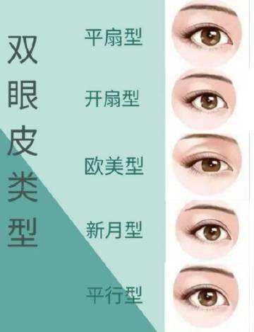 图解四类双眼皮 三大术式构造双眼皮