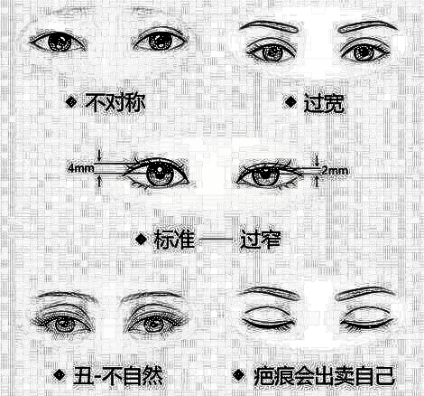 双眼皮手术风险大吗?术后需要注意什么呢?