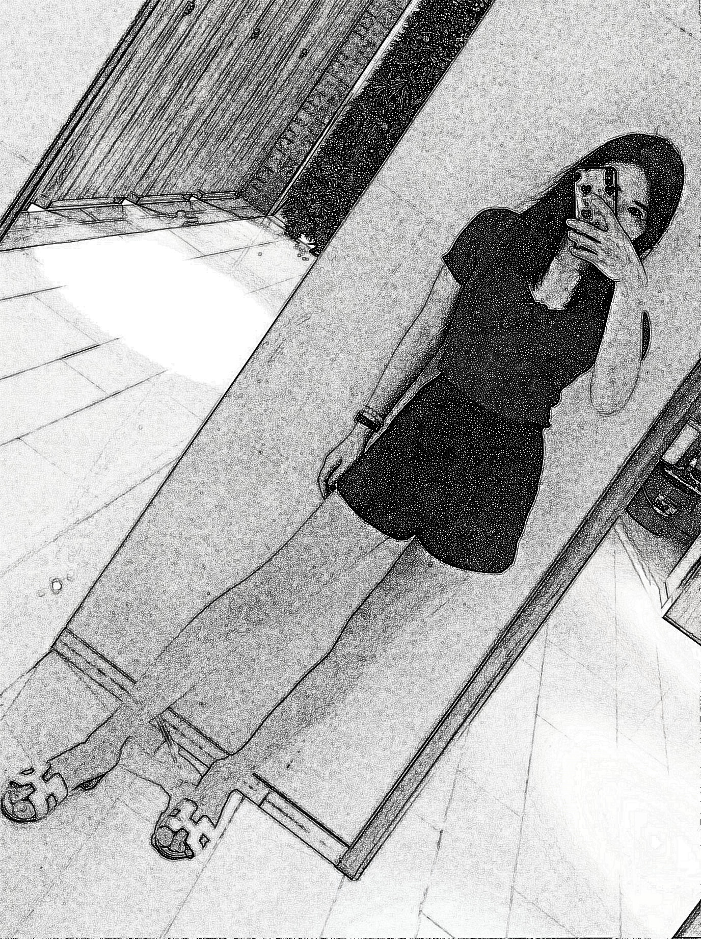 广州美莱张毓大腿吸脂怎么样?有介绍吗?