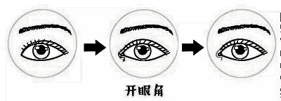 眼部手术你还认为只是切开双眼皮吗?