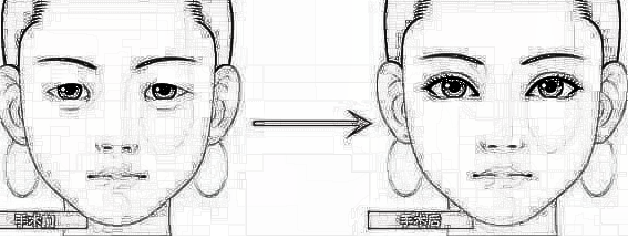 您了解双眼皮手术的一些误区吗？