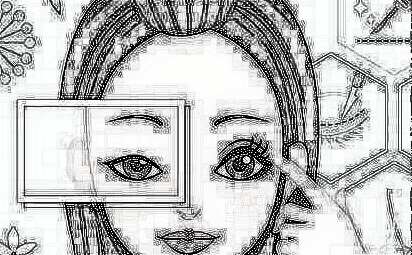您了解双眼皮手术的一些误区吗?