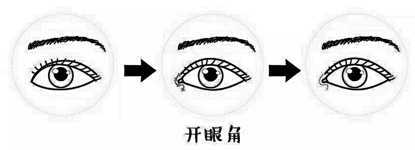 眼角开大了怎么办?可以修复吗?