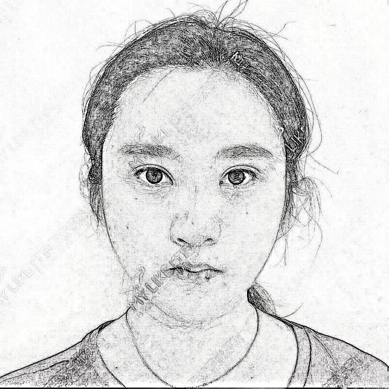 宁波美莱整形隆鼻果怎么样？