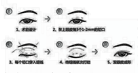 双眼皮的好处你都知道吗？