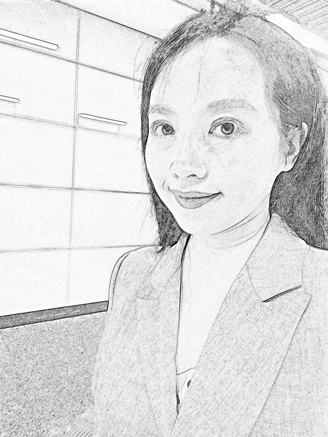 重庆郑荃丽格医美医生毛钰婷激光去眼袋介绍分享！