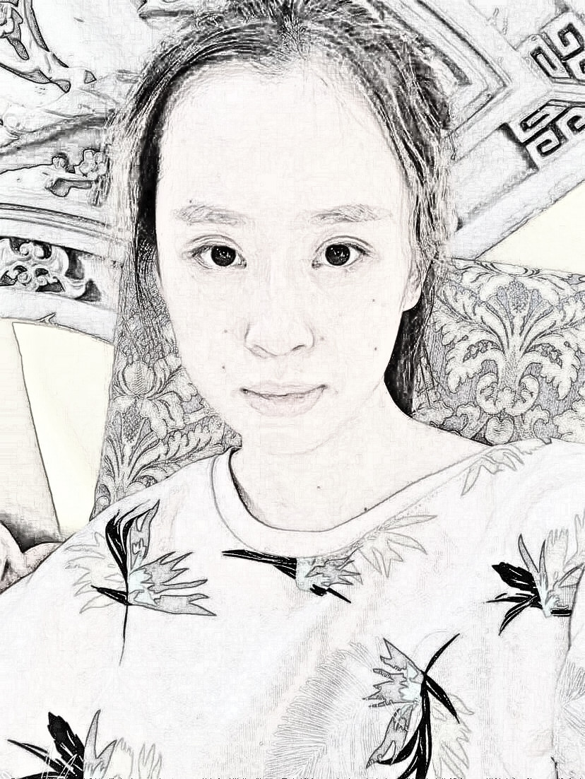 激光去眼袋果怎么样？去眼袋一个月术后介绍！