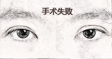 为什么北京的双眼皮修复价格要贵一些？