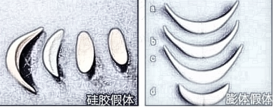隆鼻硅胶和膨体有什么区别?如何选择?