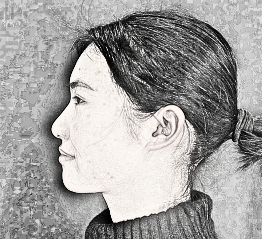 俊泰丽格医疗美容医生薛志强肋软骨隆鼻介绍分享!