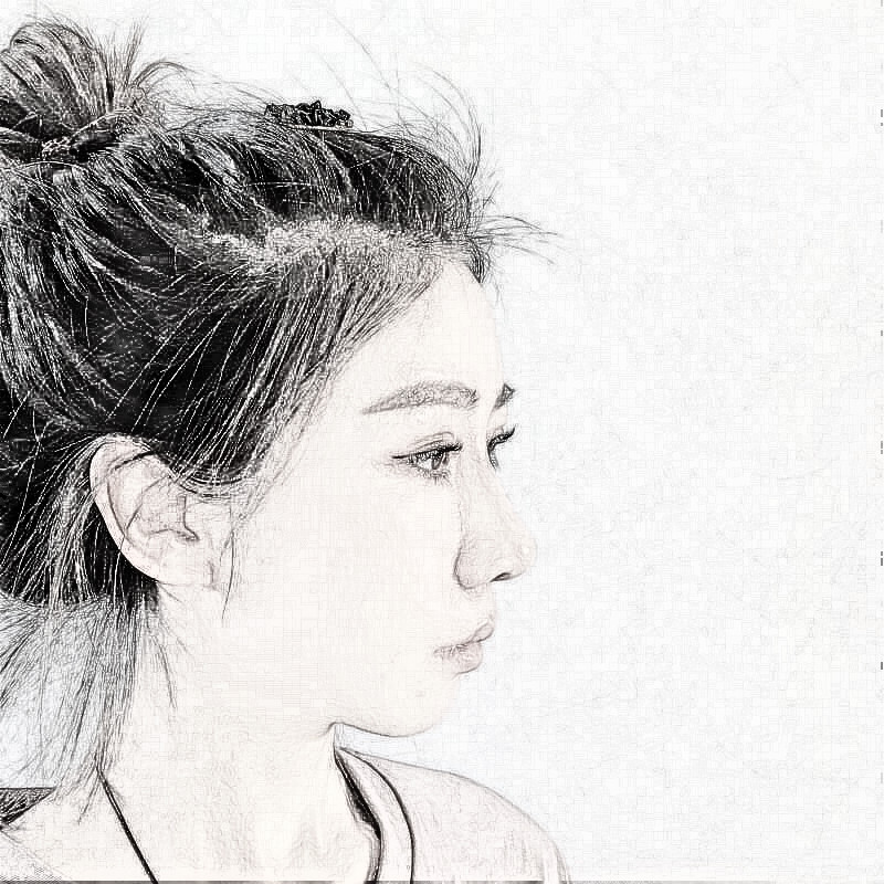 沈阳杏林整形外科医院膨体隆鼻果怎么样？