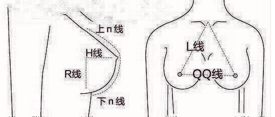 隆胸失败修复的方法和较佳时间！