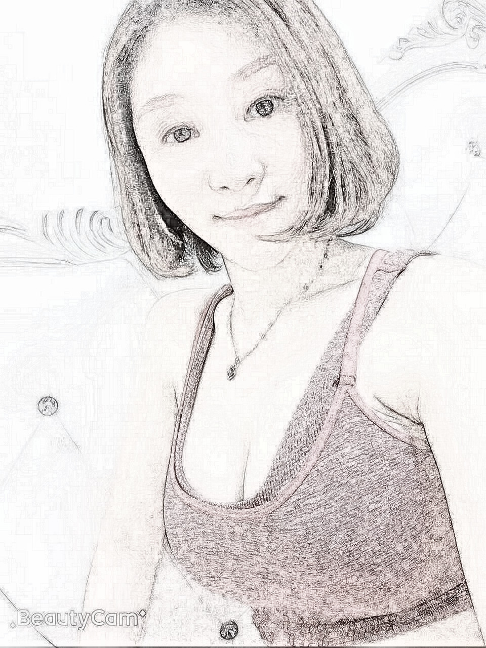 假体隆胸果怎么样？福州美莱华隆胸术后180天介绍分享！