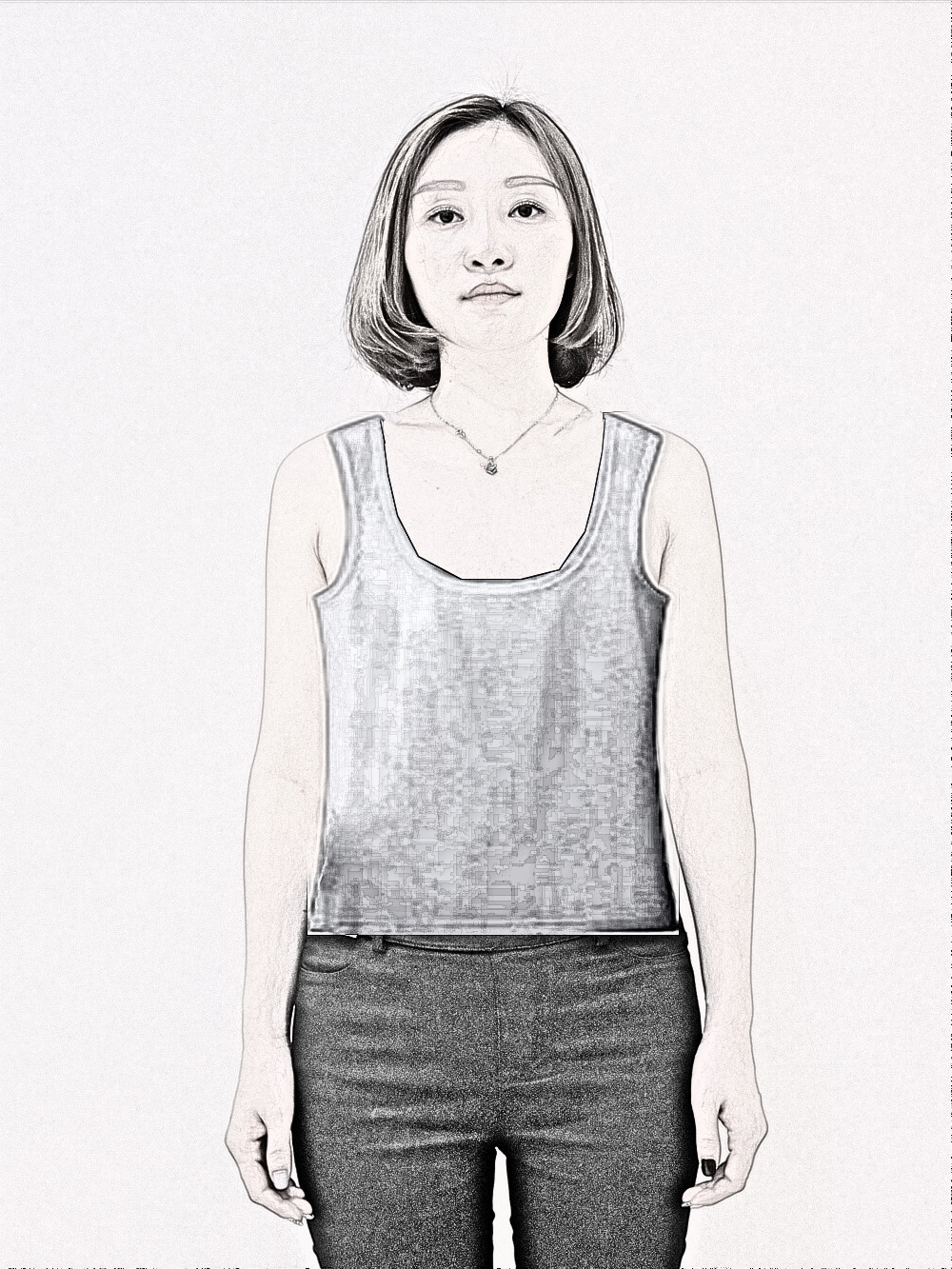 假体隆胸果怎么样？福州美莱华隆胸术后180天介绍分享！