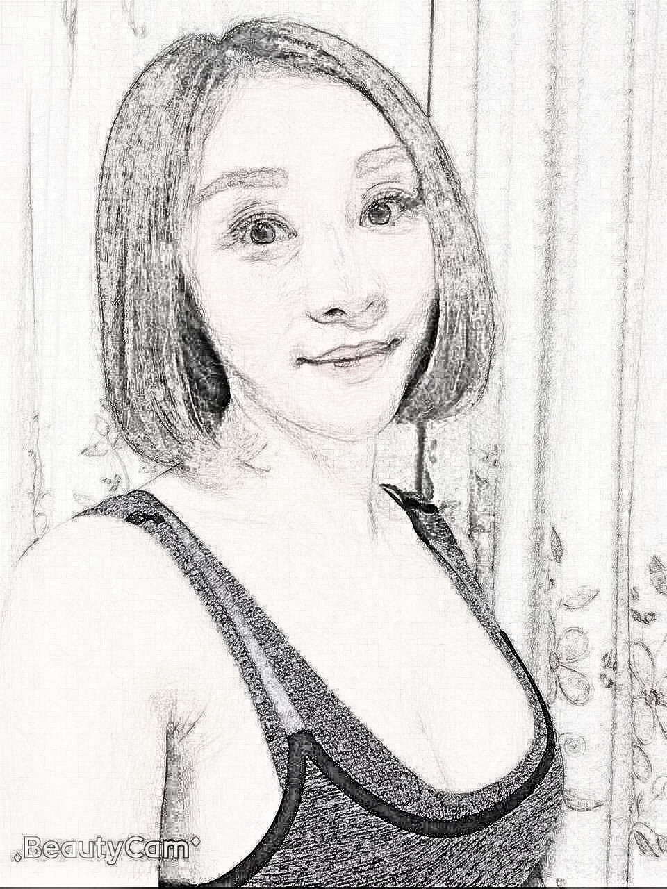 假体隆胸果怎么样？福州美莱华隆胸术后180天介绍分享！