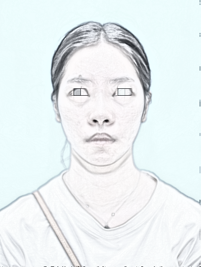 成都润美玉之光刘面部填充怎么样？