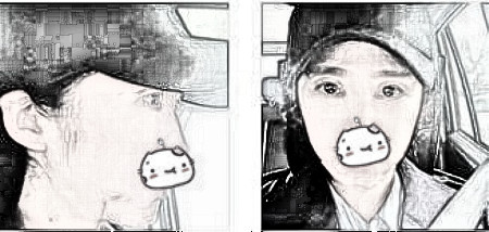上海艺星医美切开双眼皮+假体垫下巴术后感受及术后果分享!