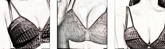深圳爱美者假体隆胸术后90天果分享!看下果如何?