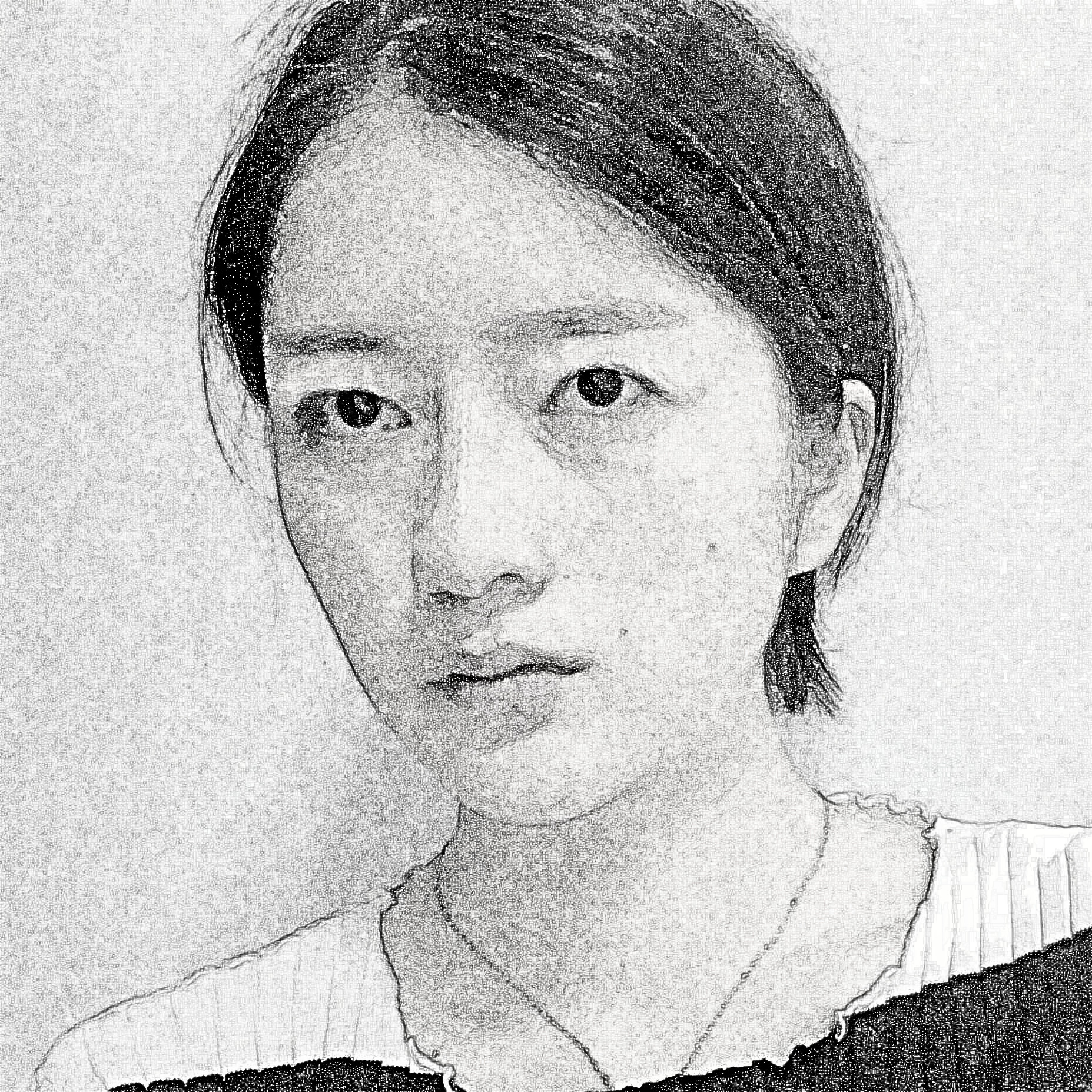北京圣慈医疗美容医院做的双眼皮怎么样？多少钱？