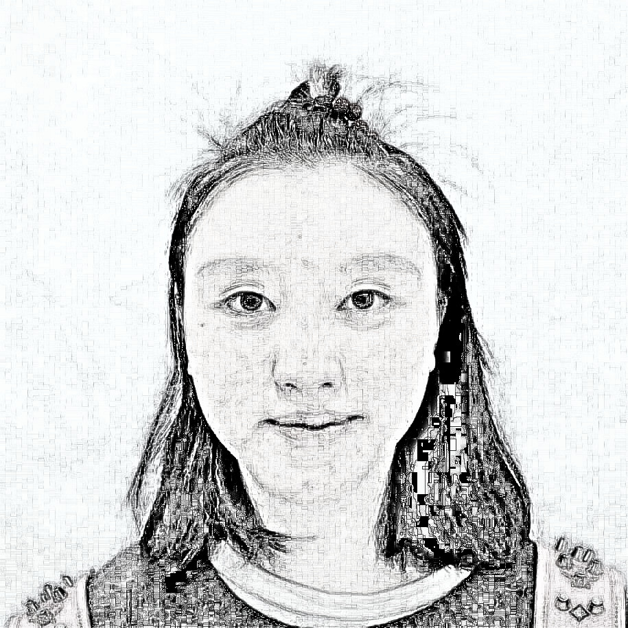 杭州港丽医疗美容曹飞超做的双眼皮介绍果分享