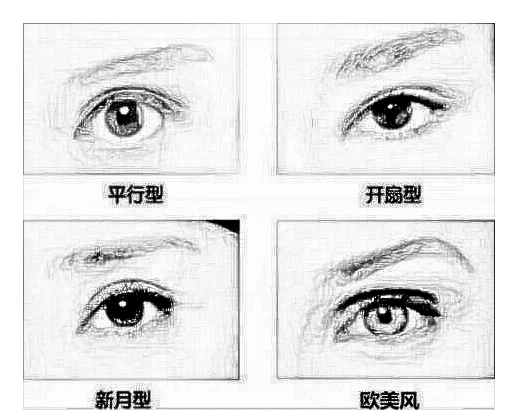 武汉全切双眼皮的费用是多少呢？
