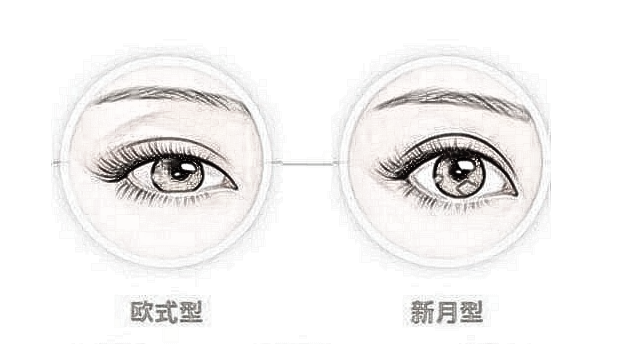 武汉全切双眼皮的费用是多少呢?