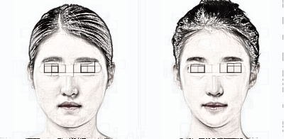 想要瘦脸都有哪些医美手术方法？