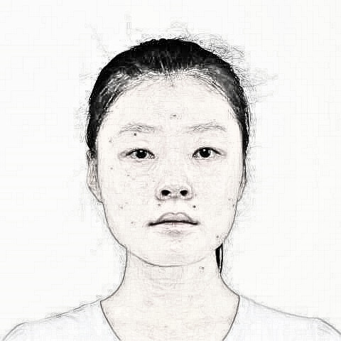 重庆华美潘宝华院长做的下颌角整形,我的尖下巴真的慕了!!