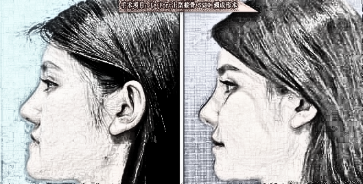 在上海做整形下颌角削骨磨骨需要多少钱?
