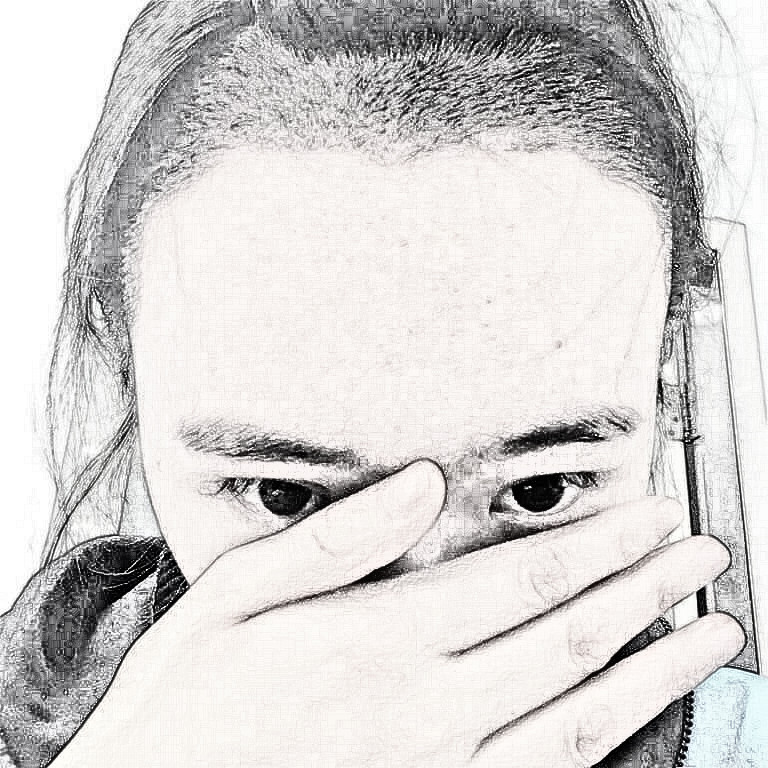 雍禾植发医生张东宏种植发际线介绍分享!