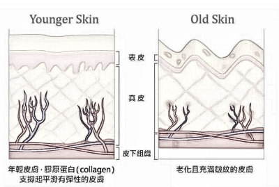 对于这几个【热玛吉、热拉提、超声提拉】常见的抗衰保养项目,你知道怎么选吗