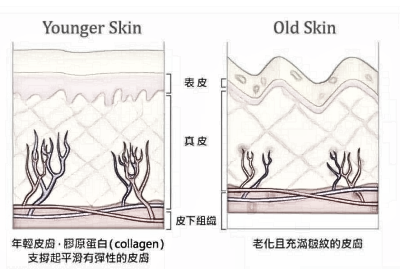 对于这几个【热玛吉、热拉提、超声提拉】常见的抗衰保养项目，你知道怎么选吗