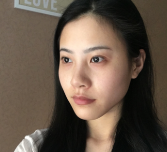 北京小芙医疗美容医院第四代“热麻吉”果分析，介绍分享