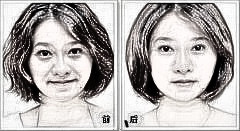 热玛吉除皱的有关知识。