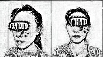 北京爱美者全脸自体脂肪填充过程感受分享附分享图!
