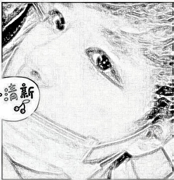 广州爱美帅哥隆鼻,术后果带图分享!