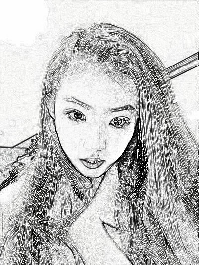 上海薇琳医疗美容切开双眼皮介绍分享！