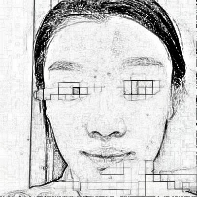 宜昌第二人民医院医学美容科光子嫩肤介绍分享！
