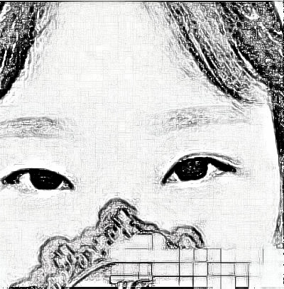 北京尹林丽格医疗美容切开双眼皮术后感受分享!