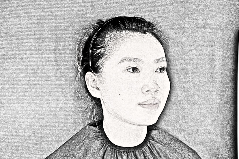 肋软骨隆鼻果怎么样？俊泰丽格医疗美容介绍