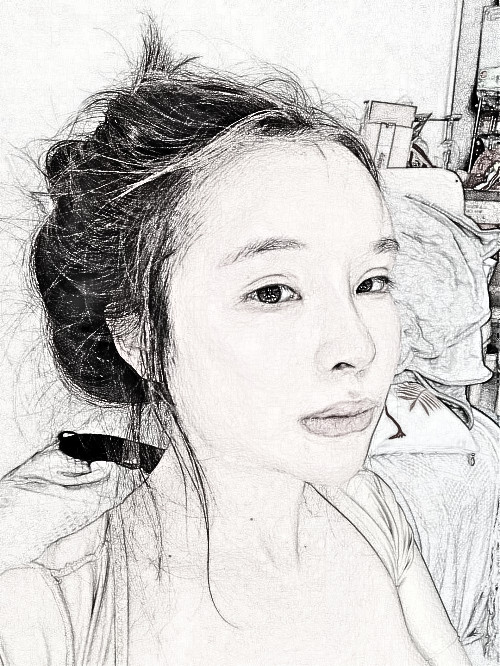 广东爱美者下颌角整形术后7周附分享！