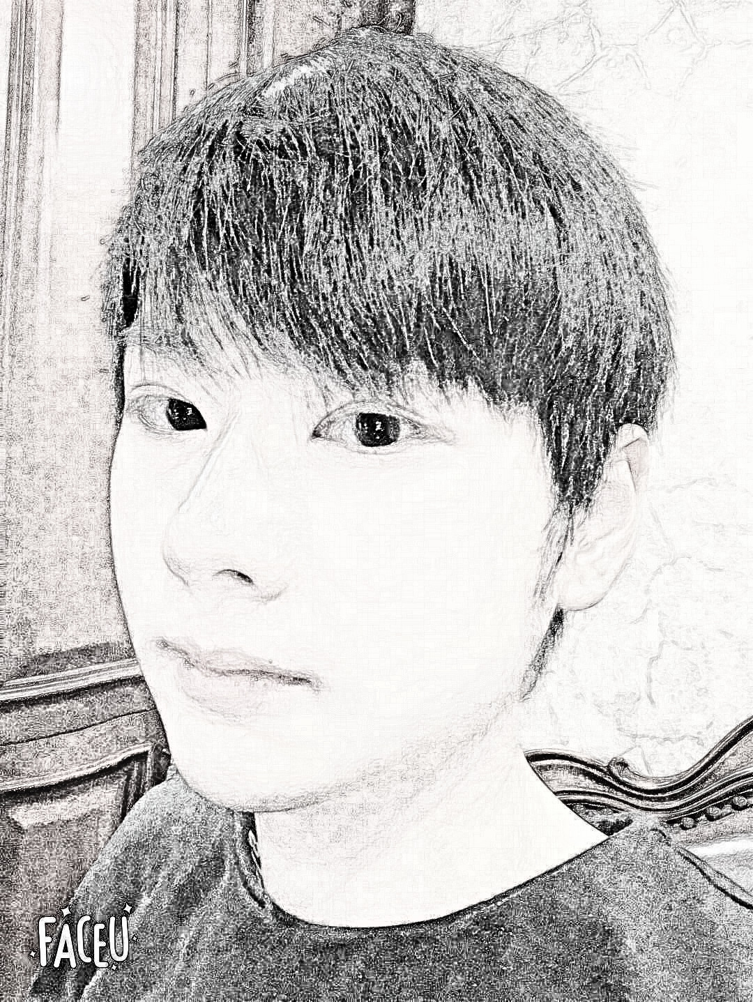 杭州时光医美医生陈小平下颌角整形介绍分享!