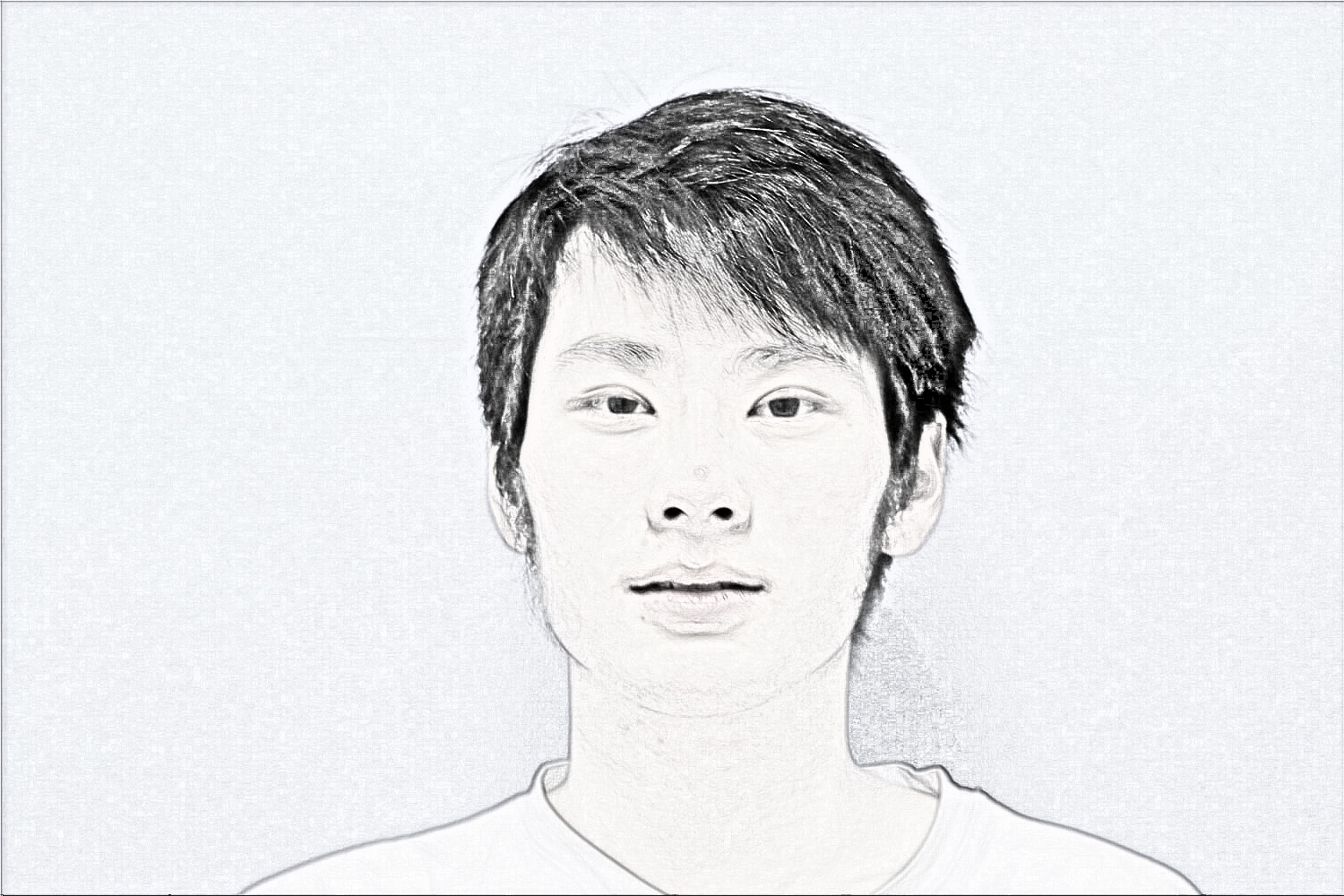 杭州时光医美医生陈小平下颌角整形介绍分享!