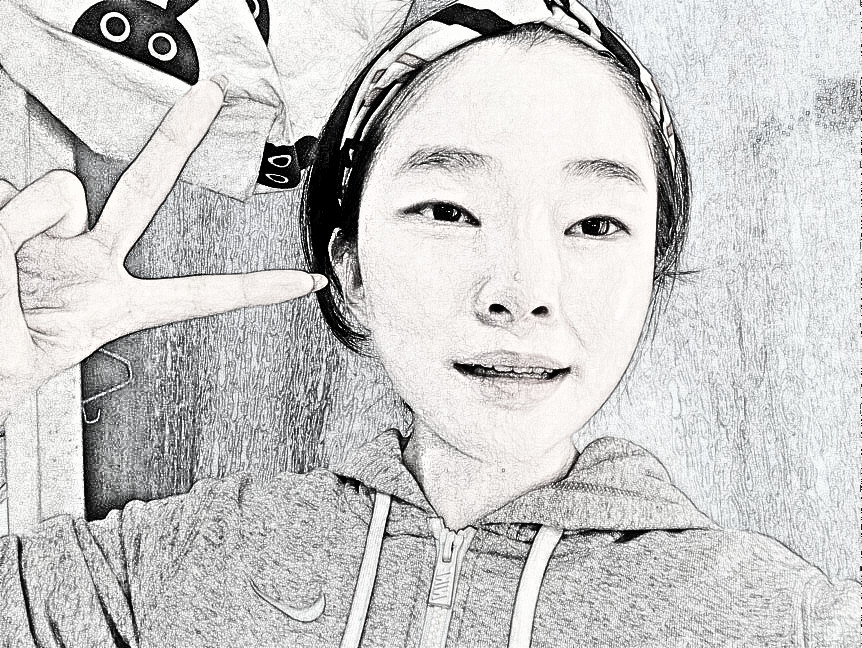 丰泽黄惠铭医疗美容诊所切开双眼皮介绍分享!