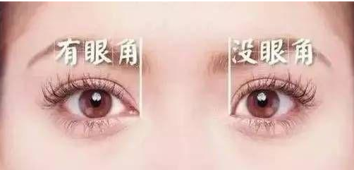 美丽的内眼角有什么特点?