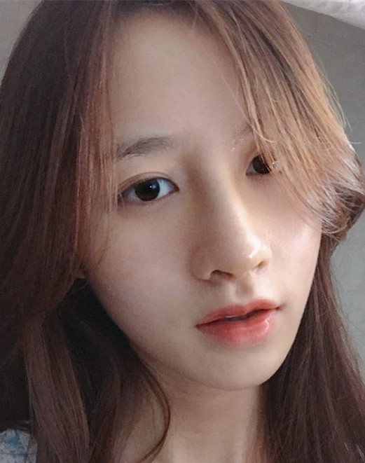 芜湖壹加壹医疗美容鼻部手术介绍分享！