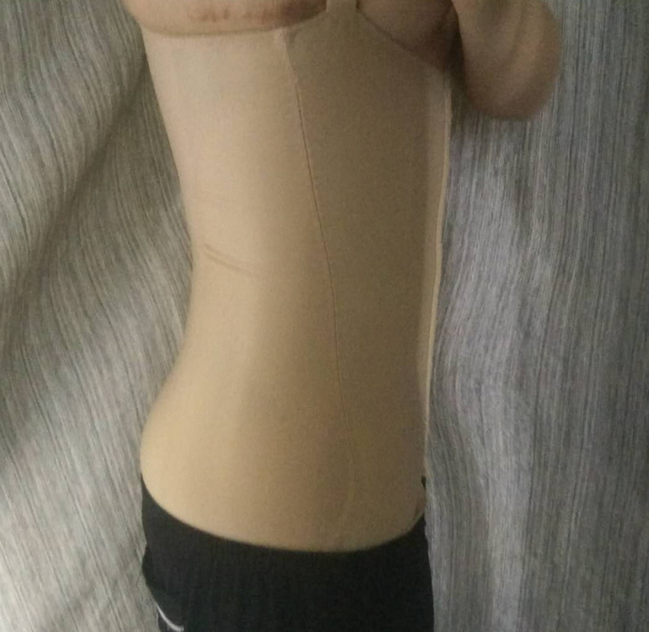 南京美莱整形腹部吸脂怎么样呢?