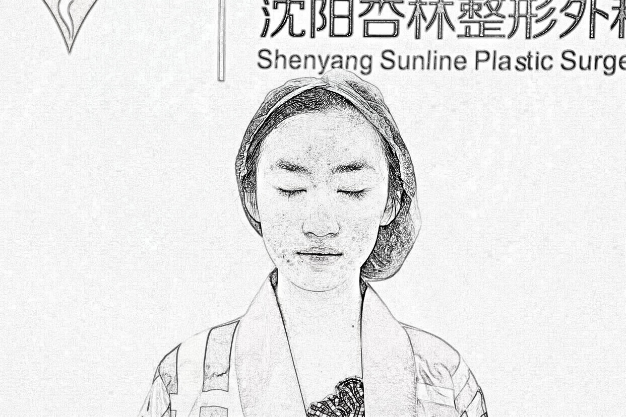 沈阳杏林整形外科医院切开双眼皮果怎么样?